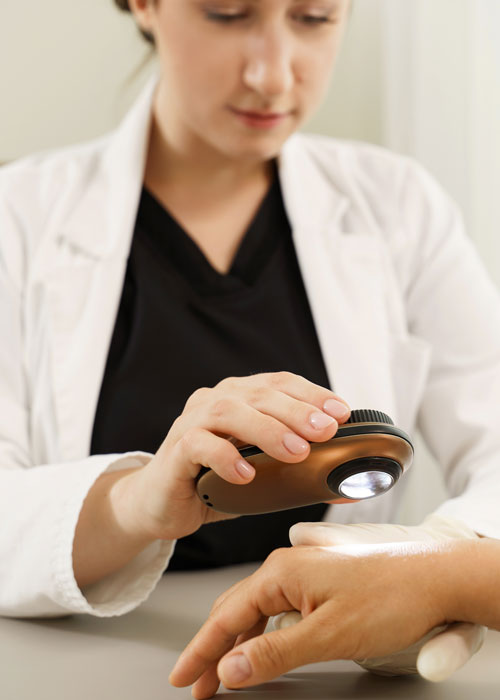 dermatoscopie