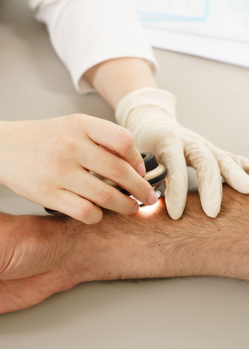 Examen cutané au dermatoscope en médecine générale