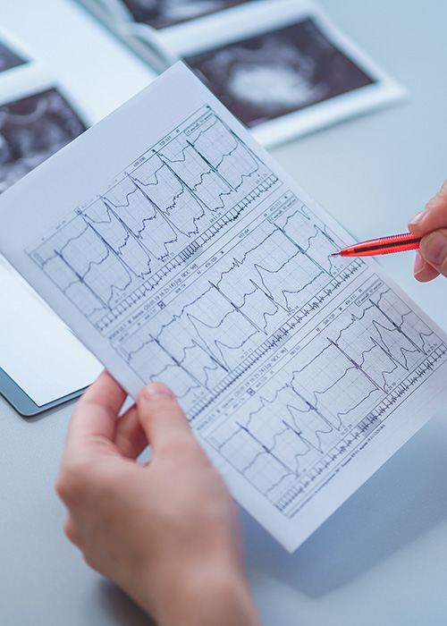 Médecin qui annote un tracé ECG